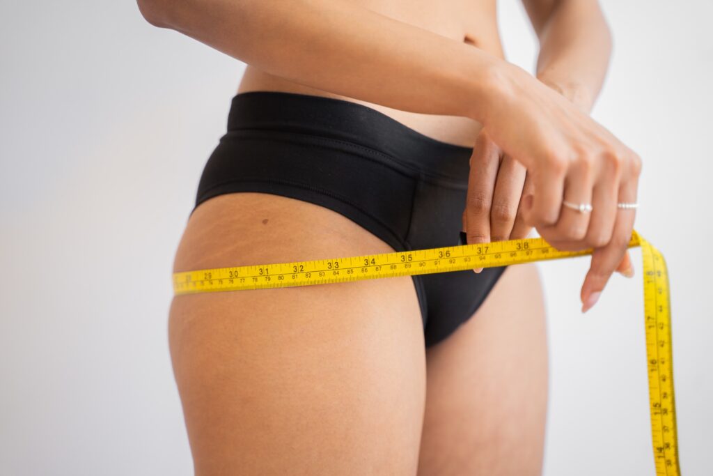 Thigh lift; thigh liposuction